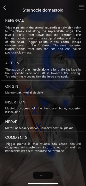 Muscle Trigger Points(圖3)-速報App