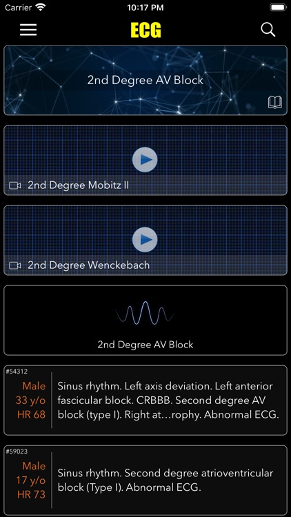 ECG Pro