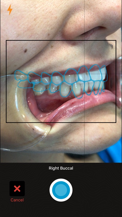 Invisalign Photo Uploader