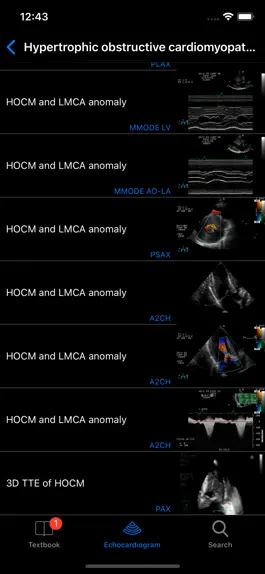 Game screenshot CARDIO3®Echocardiography apk