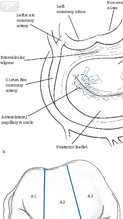 Cardiac Surgery in Adults, 5/E screenshot-7