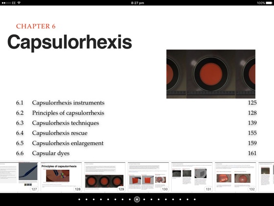 Phacoemulsification Surgery On Apple Books - 