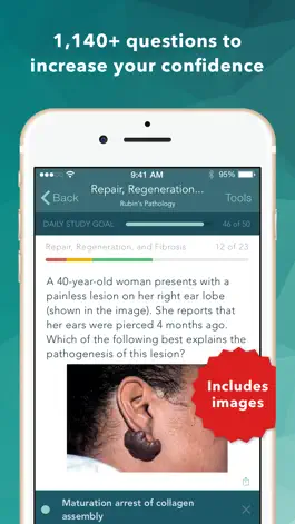 Game screenshot Rubin's Pathology: USMLE Q&A apk