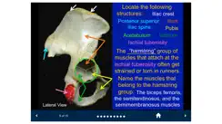 MSK Anatomy - SecondLook iPhone image 3
