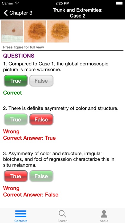 Dermoscopy Self-Assessment