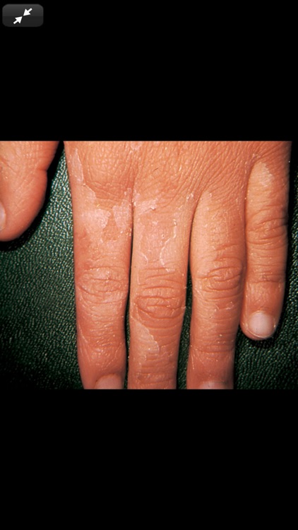 Weinberg's Ped. Dermatology 5E screenshot-7