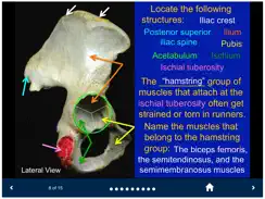 MSK Anatomy - SecondLook iPad image 3