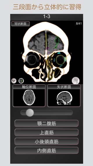 CT PassQuiz コンプリートセット 脳・腹部・胸部のおすすめ画像3