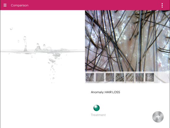 Screenshot #5 pour Shot