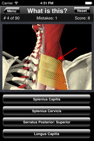 Anatomy Spine Quizのおすすめ画像5