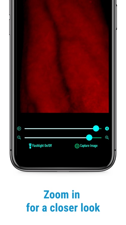 VeinScanner screenshot-3
