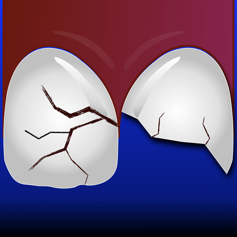 ToothSOS