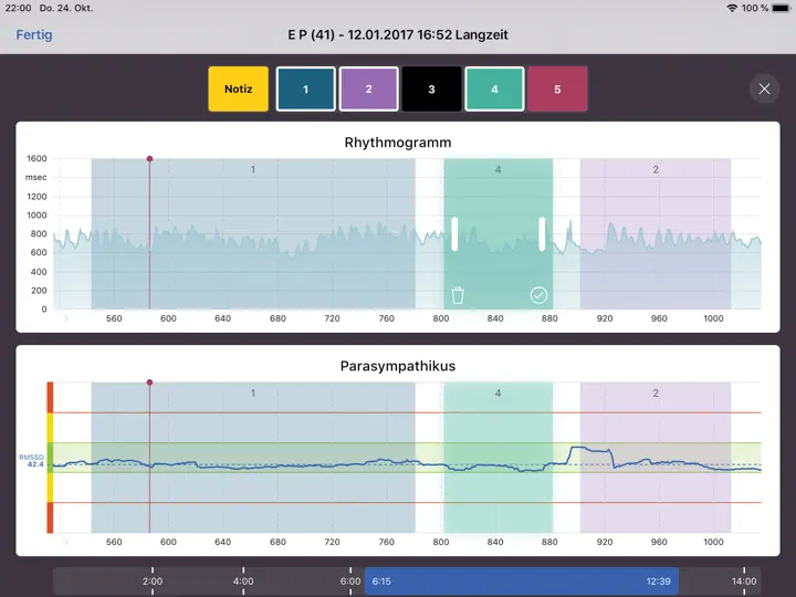 Screenshot von VNS Analyse auf dem iPhone 3