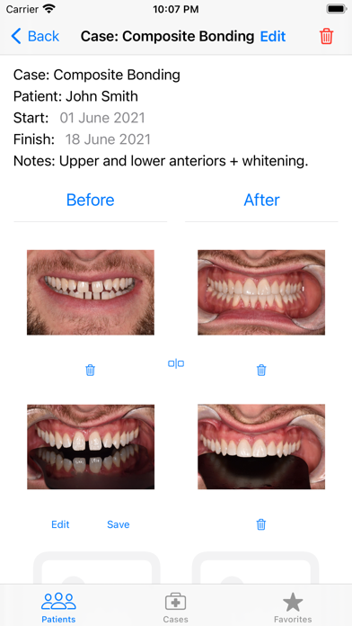 Screenshot 2 of Casebook Before & After Photos App