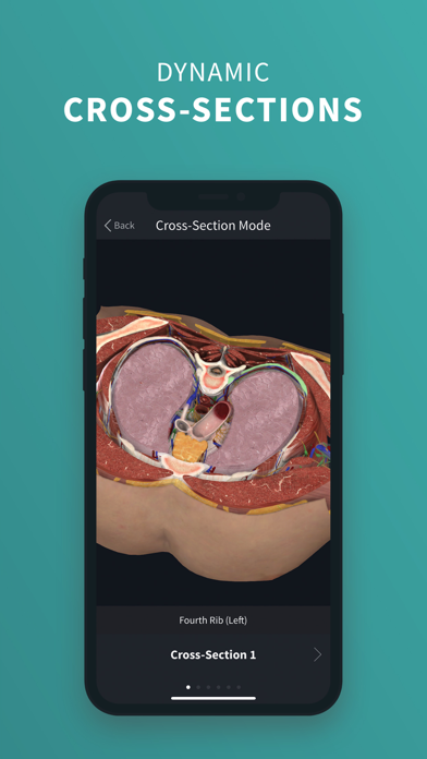 How to cancel & delete Complete Anatomy Platform '20 from iphone & ipad 3