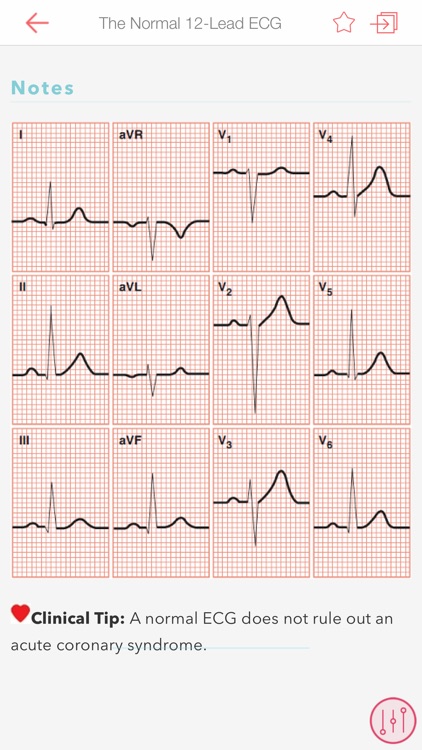 ECG Notes: Quick look-up ref. screenshot-4