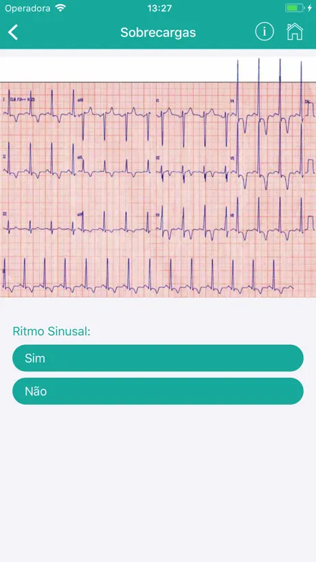 ECG Fácil