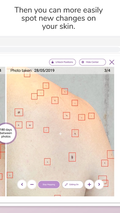 Miiskin Skin Tracker & eHealth Screenshot