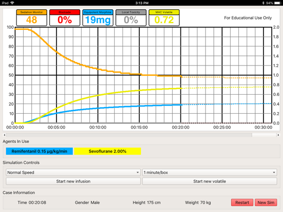 Screenshot #5 pour Brigham Anesthesia Simulator