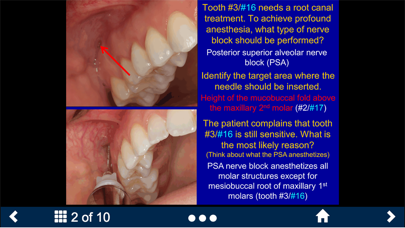 Dental Anesthesia-SecondLook screenshot 2