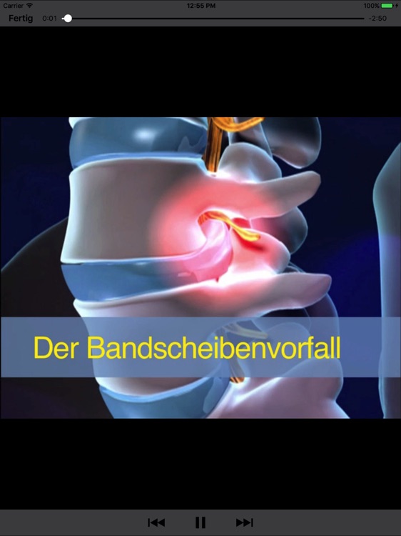 RückenDocHD Lite screenshot-4