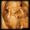 BCM OB Ultrasound