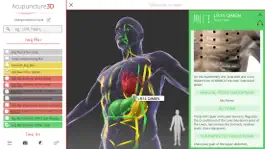 Game screenshot Acupuncture3D hack