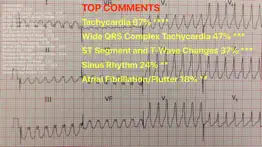 How to cancel & delete ecg reader 1