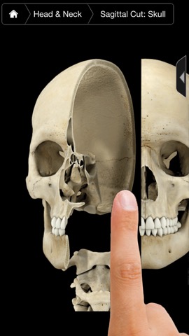 3D4Medical Body Systems for iPhoneのおすすめ画像4