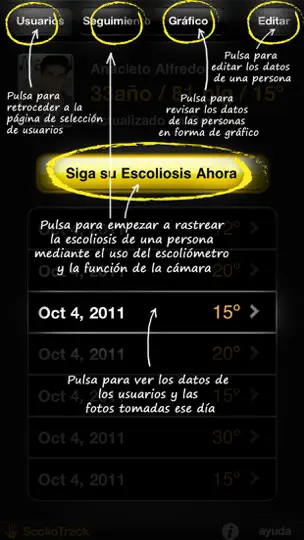Captura de pantalla de ScolioTrack en iPhone 2