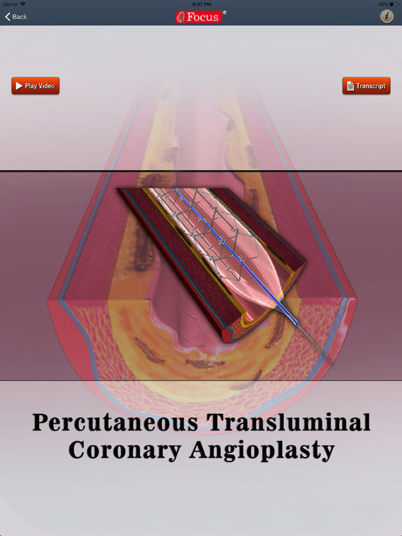 Screenshot #5 pour Understanding Diseases