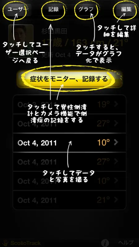 ScolioTrack (脊柱側弯計) screenshot 2 of 10