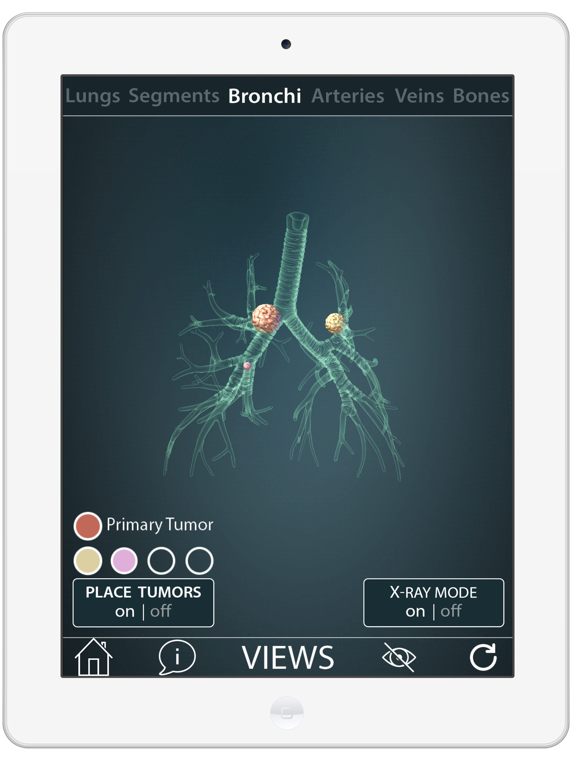 Screenshot #4 pour Surgical Anatomy of the Lung