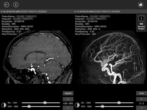 DICOM Viewer : eMmaのおすすめ画像4