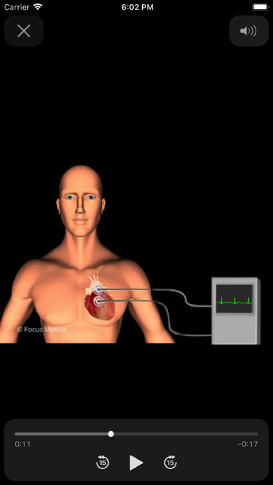 Cardiology Dictionaryのおすすめ画像5