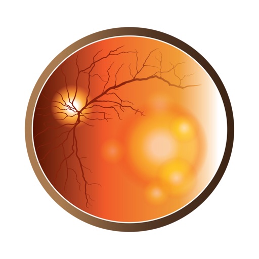 AMD & Anti-VEGF Therapy