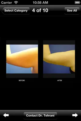 Game screenshot iLipo Plastic Surgery apk