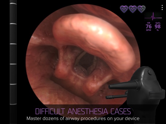 Airway Exのおすすめ画像1