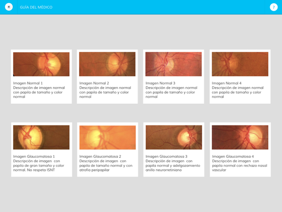 Screenshot #6 pour OcularApp