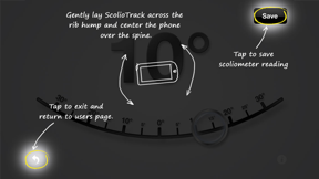 ScolioTrack screenshot
