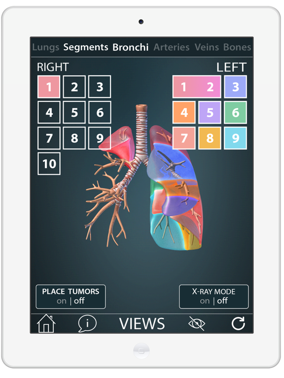 Screenshot #5 pour Surgical Anatomy of the Lung