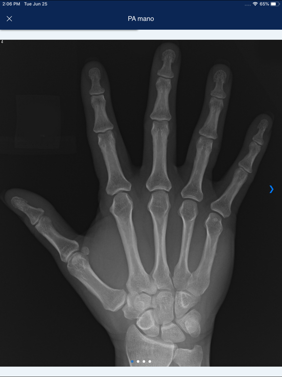 MSK RADIOLOGY 4 U iPad screenshot 5 - Medical app