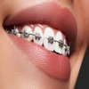 Orthodontic icon