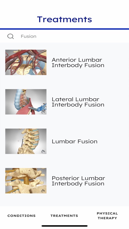 Spine Decide
