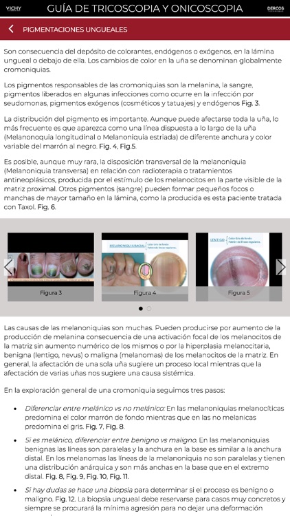 Guía tricoscopia y onicoscopia
