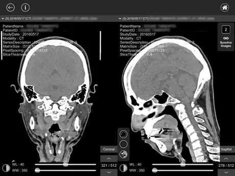 DICOM Viewer : eMma