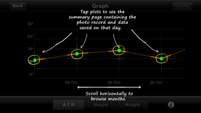 ScolioTrack screenshot