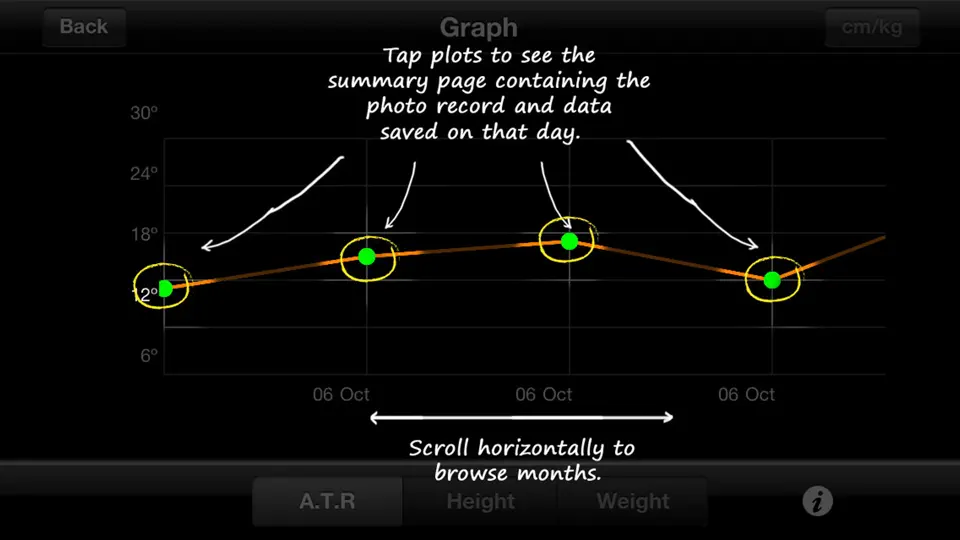 ScolioTrack iPhone Ekran Görüntüsü 10