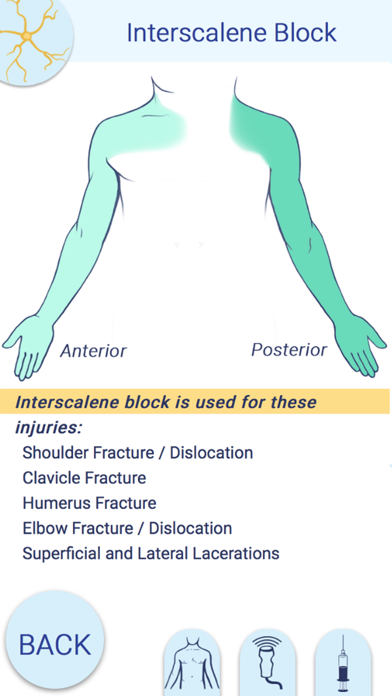 Nerve Block Star App screenshot 3