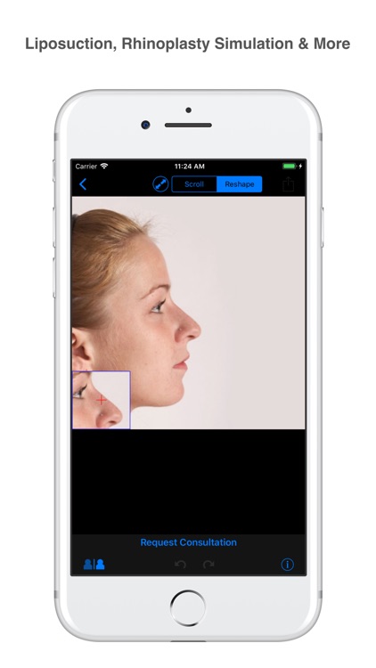 iLipo Plastic Surgery